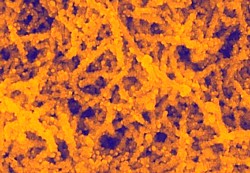 Gold-Nanopartikel